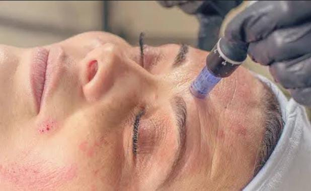 Vampayer Treatment Now in Rajkot!